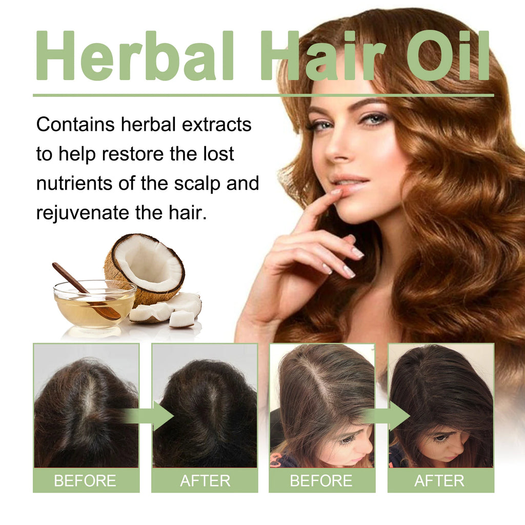 100ml Hair Growth Oil India Adivasi Herbal Hair Care Rosemary Repair Damaged Hydrate Moisturize Scalp Reduce Dandruff Oasis Select