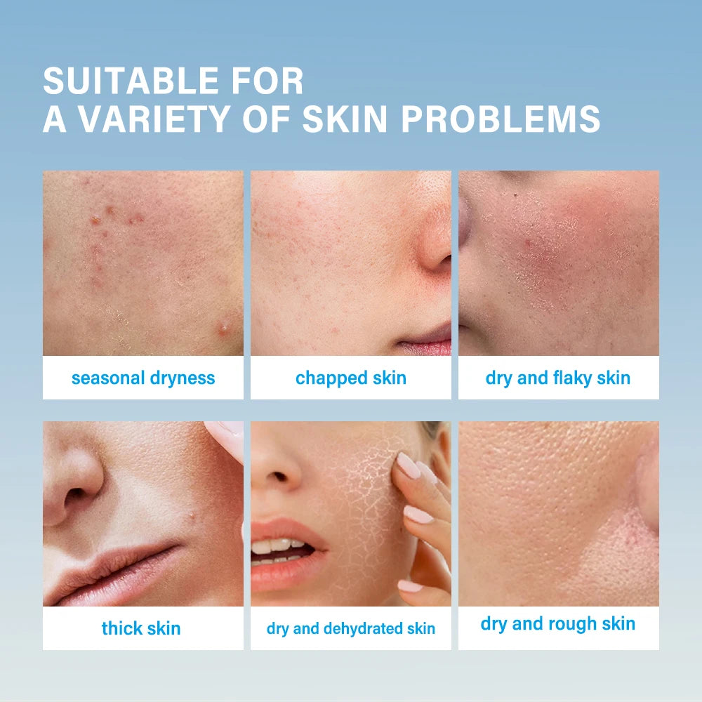 Lakerain Hydration Bomb Face Cream – All Skin Types, 100ml Facial Moisturizer Cream Oasis Select