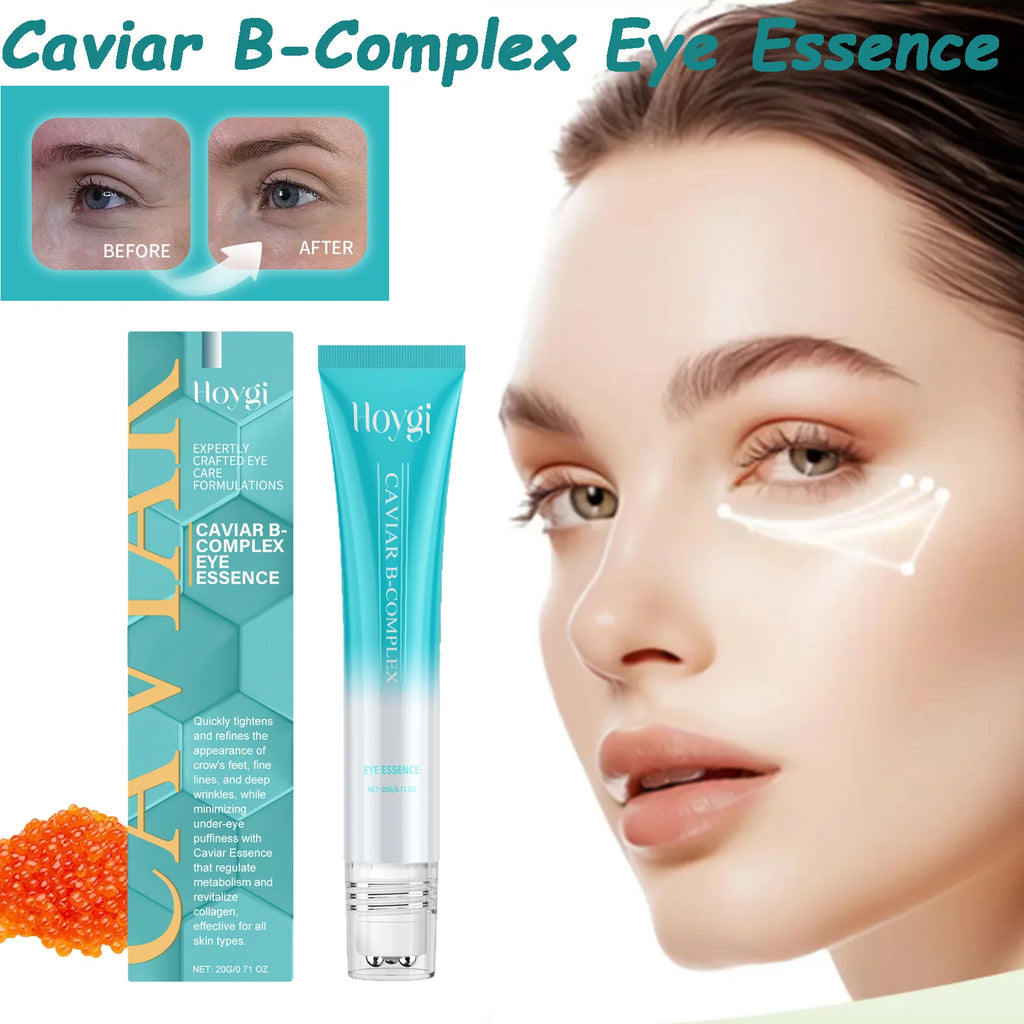 Caviar B-Complex Eye Essence Remove Dark Clrcles Anti Puffiness Smoothing Fine Lines Moisturize Skin Around the Eye Serum Oasis Select