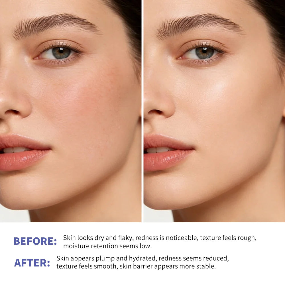 Triple Lipid Peptide Cream Long-lasting Moisturizing Deep Hydration Skin Care Face Cream for Dry Sensitive Skin Treatment Oasis Select