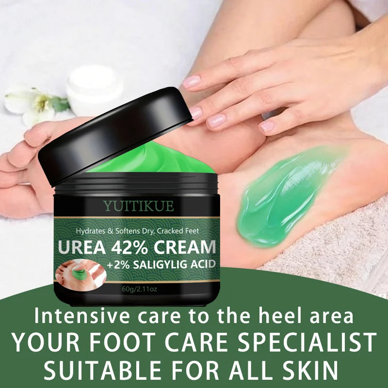 YUITIKUE 42% Urea Foot Cream – Callus & Dry Heel Repair
