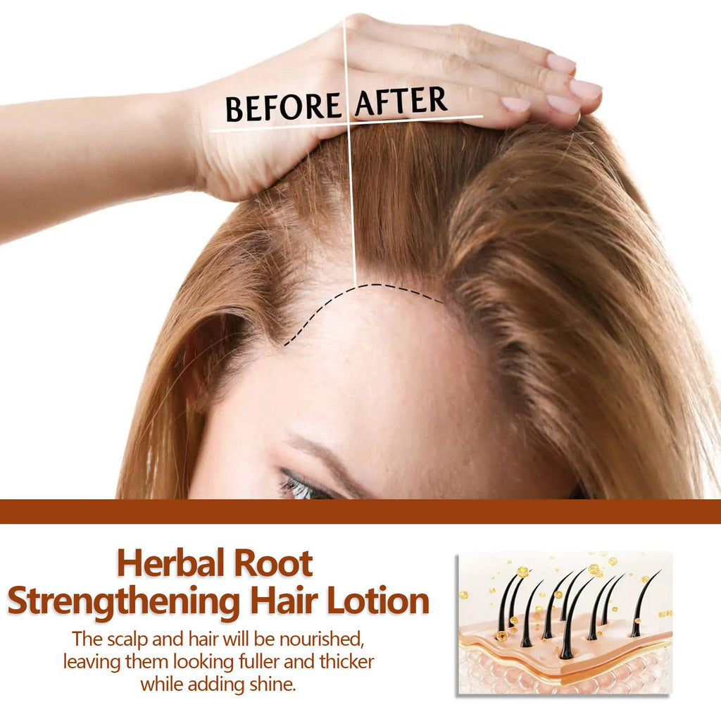 EELHOE Hair Growth Shampoo – Anti-Hair Loss & Scalp Repair Hair Growth Shampoo Oasis Select
