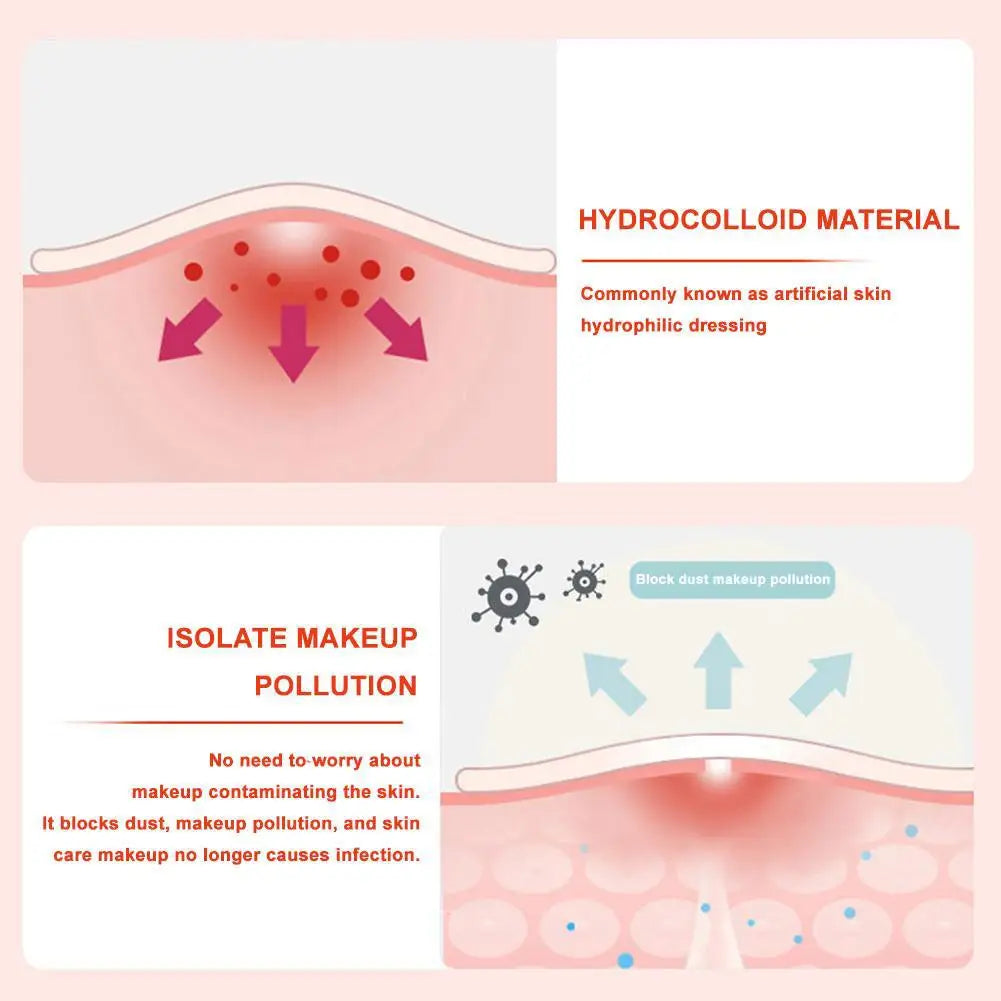 600 Counts Colorful Star Spot Acne/Pimple Patch For Face, Hydrocolloid Cute Star Shaped Acne Patch Invisible Zit Cover Stickers Oasis Select