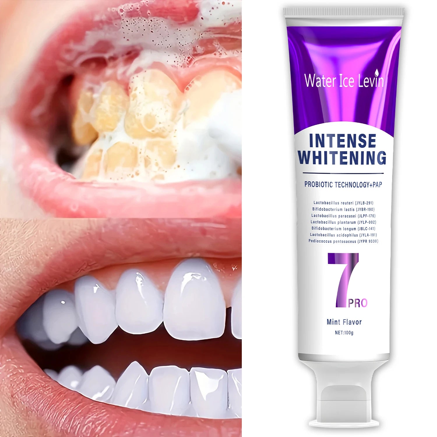 Probiotic Whitening Toothpaste – Fresh Breath & Gum Care Probiotic Toothpaste Oasis Select