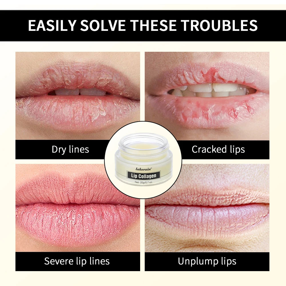 Lip Balm Collagen Lighten Melanin Lip Mask Exfoliating Fade Lip Line Dead Skin Moisturizing Brighten Repair Lip Care Products Oasis Select