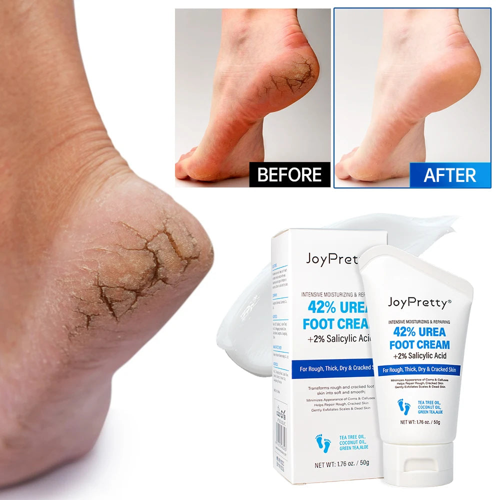 Urea Foot Cream Moisturizing Exfoliating Hand Feet Dead Skin Removal Anti Peeling Heels Repair Mask Foot Skin Care Products Oasis Select