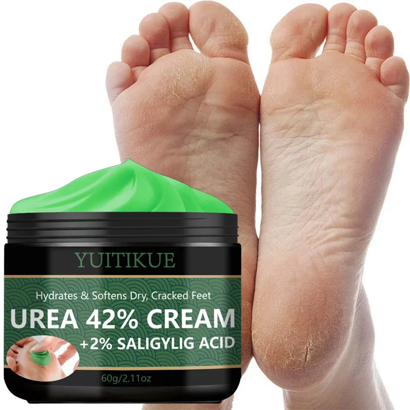 YUITIKUE 42% Urea Foot Cream – Callus & Dry Heel Repair