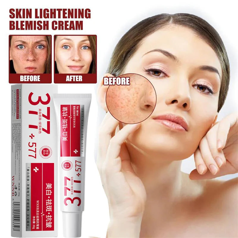 Powerful Spot-Removing Whiten Cream Brighten Skin Fast Eliminates Melanin Pigmentation Melasma Dark Spots Korean Face Skin Care Oasis Select