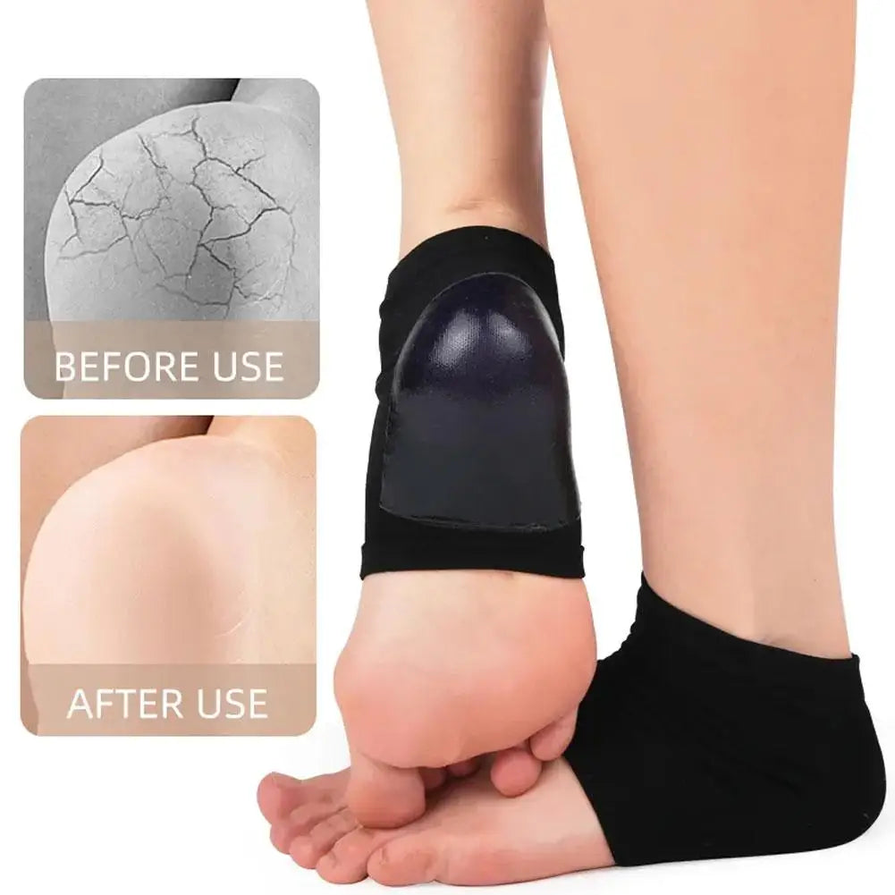 2PCS Gel Moisturizing Heel Socks Spa Sock For Foot Care Gel Heel Socks For Dry Cracked Dry Feet Skin Gel Heel Repair Socks Tools Oasis Select