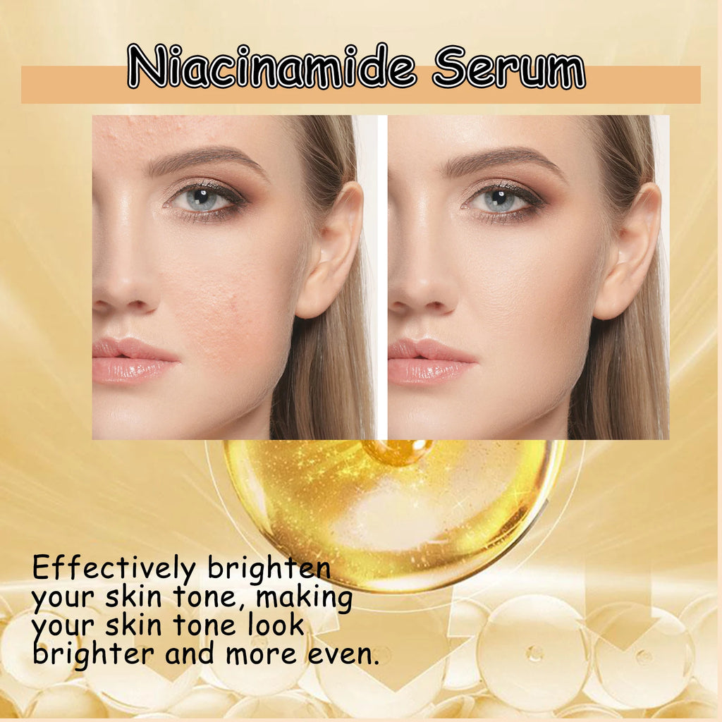 Nicotinamide Face Serum Brightening Moisturizing Smoothing Shrink Pores Facial Essence Glowing Facial Moisturizer for Daily Skin Oasis Select