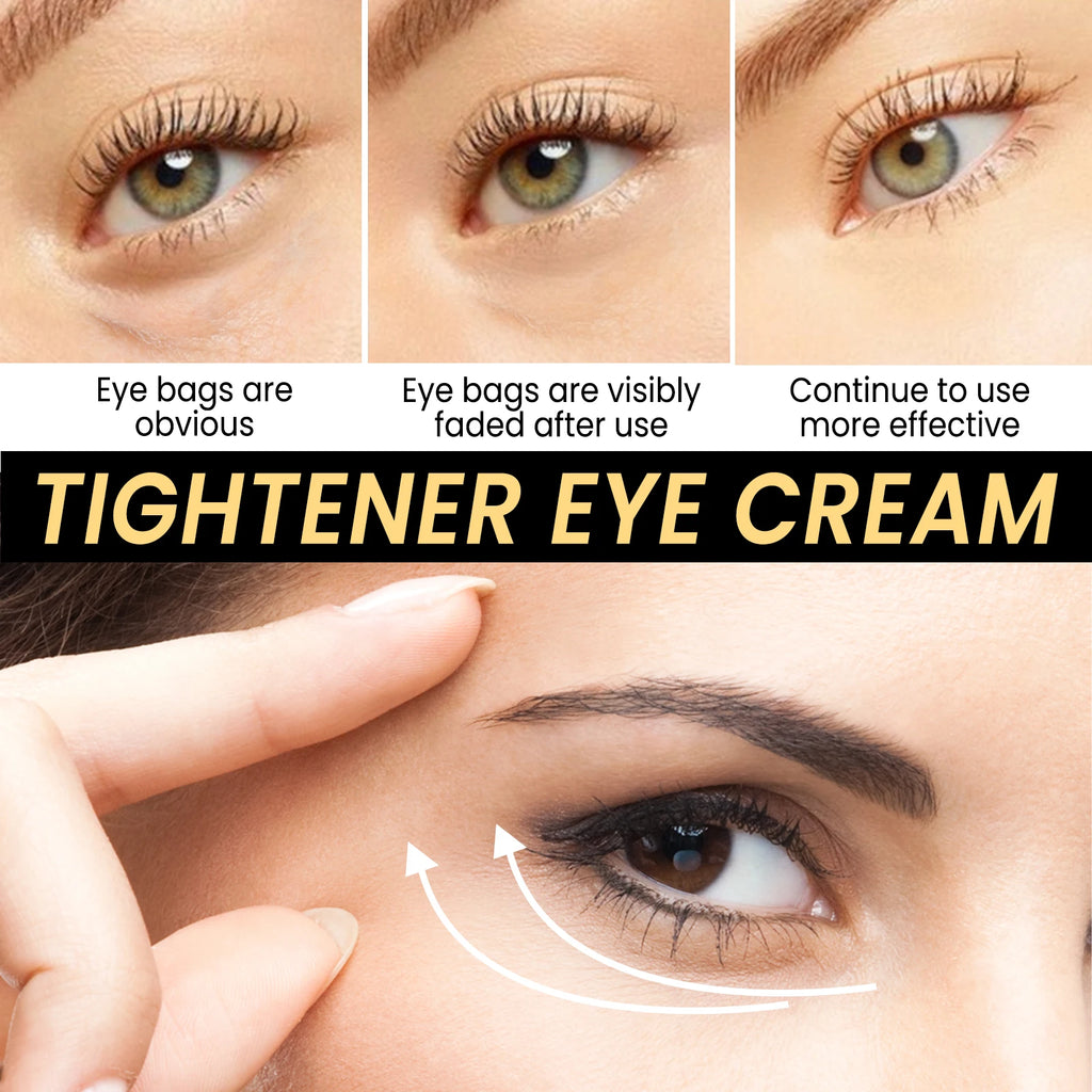Eelhoe Instant Firming Eye Cream – Dark Circles & Wrinkles