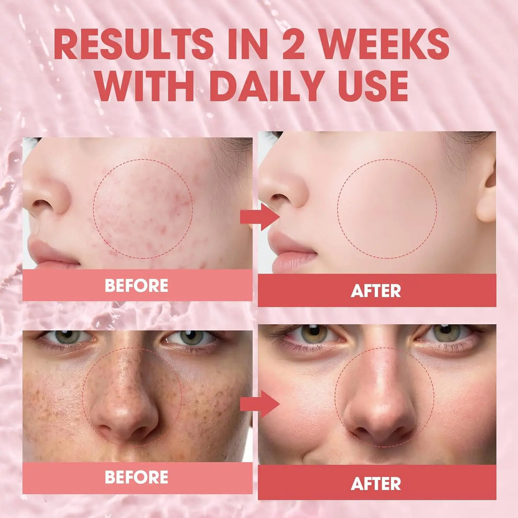 Collagen Peptide Serum – Salmon PDRN, 12 Peptides & Niacinamide
