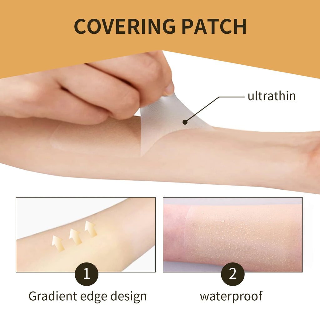 Jaysuing Scar & Tattoo Cover Patches – Waterproof Concealer Body Concealer Patch Oasis Select