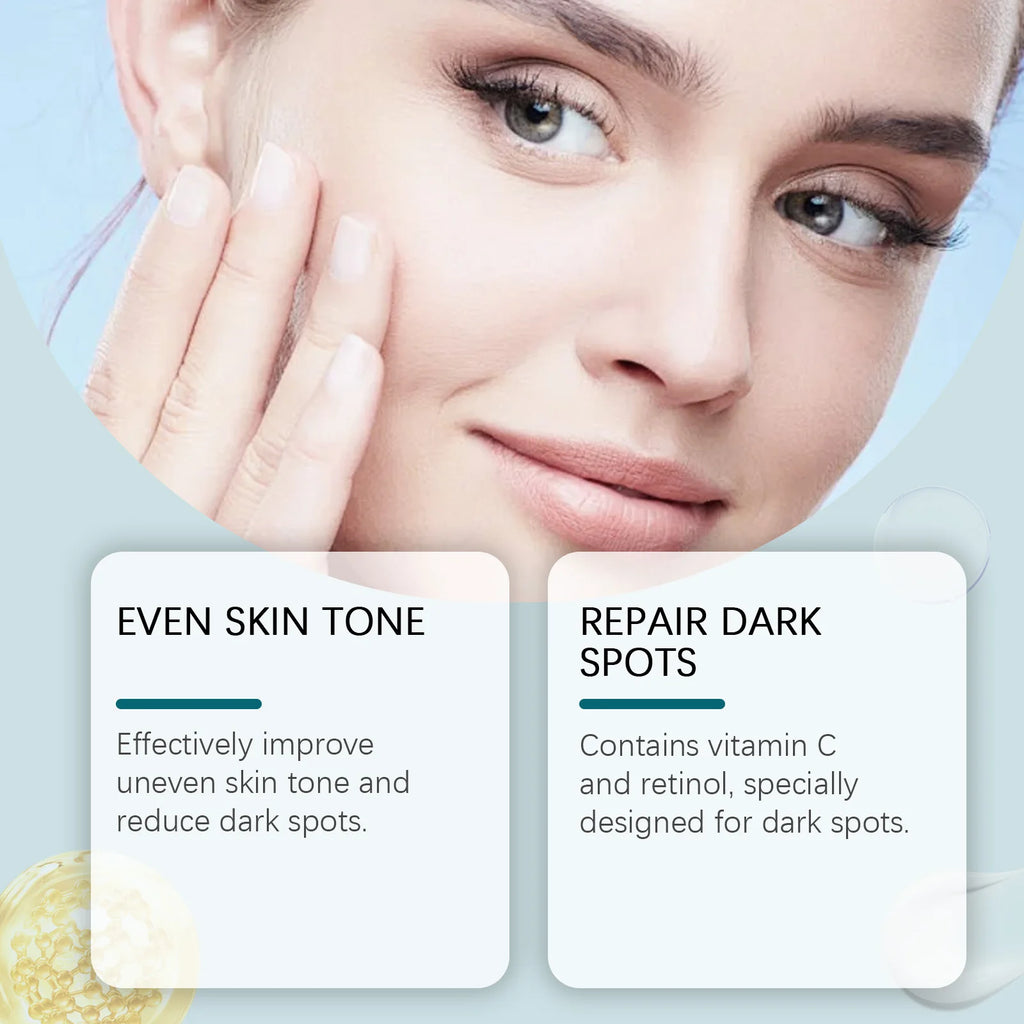 Hoygi Vitamin C Dark Spot Corrector Cream – Brightening 50g Dark Spot Corrector Oasis Select
