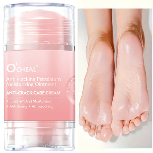 2-Pack Anti-Crack Hand & Foot Cream for Dry & Cracked Skin Hand & Foot Cream Oasis Select
