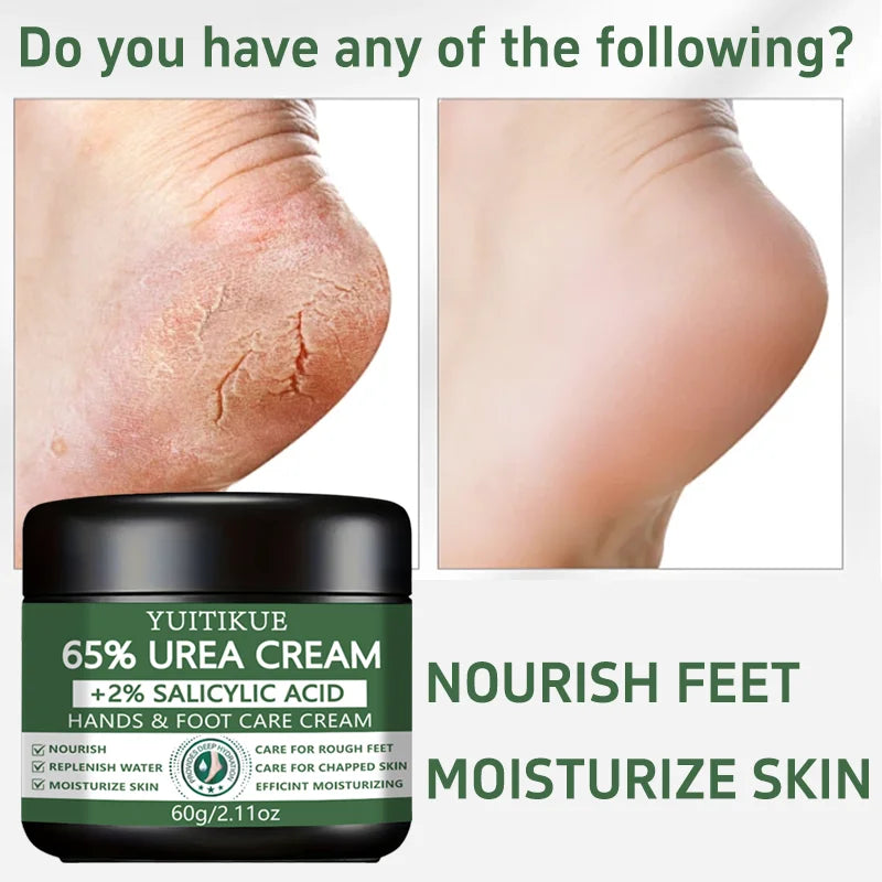 65% Urea Foot & Hand Cream – Cracked Heel Repair 60g