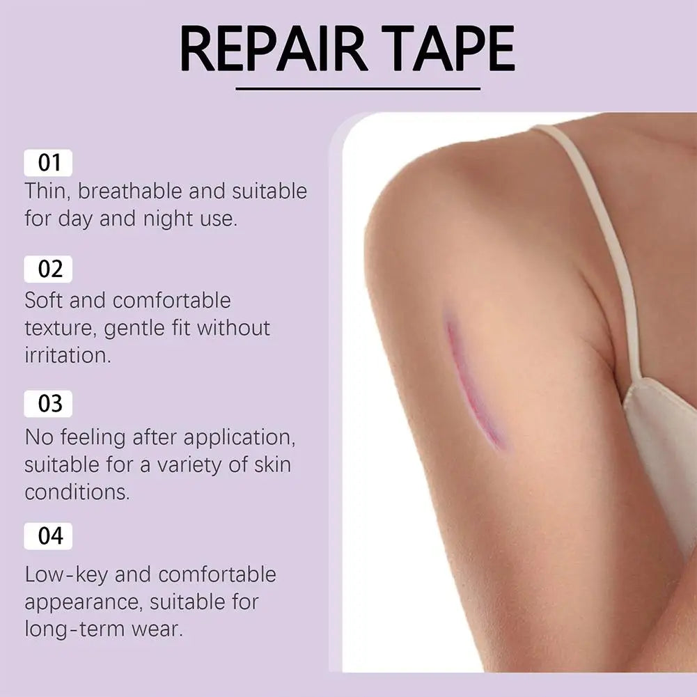 Silicone Scar Tape Roll – Surgical, Burn & Acne Scar Treatment Silicone Scar Tape Oasis Select