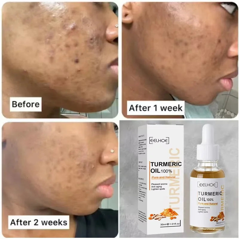 Turmeric Oil Dark Spot Brightening Facial Serum | eelhoe Brightening Face Serum Oasis Select