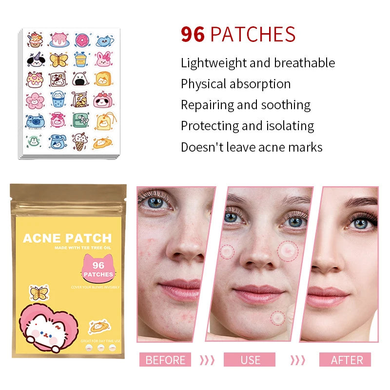 24-720pcs Hydrocolloid Invisible Breathable Pimple Patch Acne Removal Acne Cover Face Spot Pimple Patch Skin Care Stickers Oasis Select MR-08