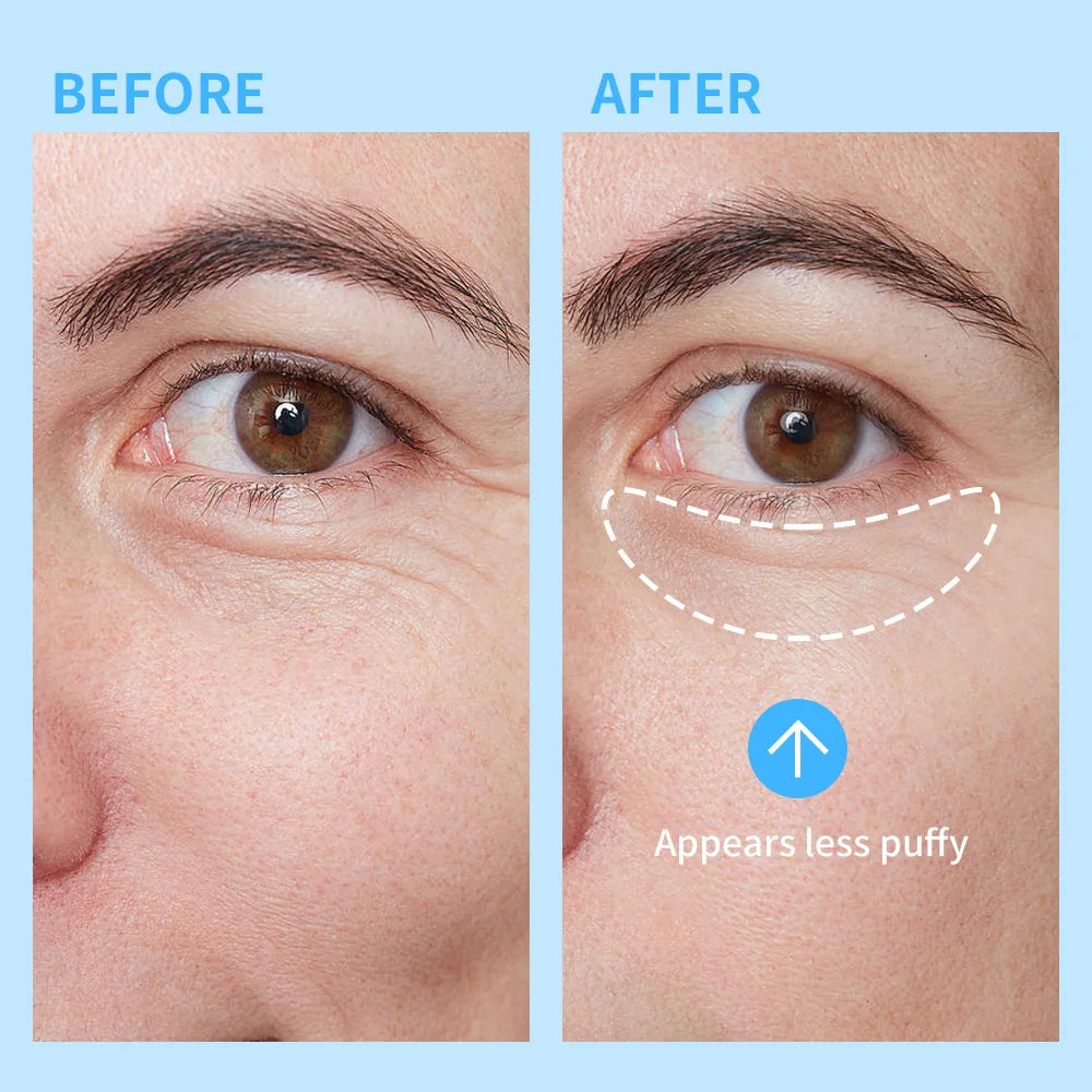 Lakerain Hydration Eye Gel Deep Hydrating Brightening Reduce Dark Circles Cool Feeling Transparent Gel Suitable for All Skin Oasis Select