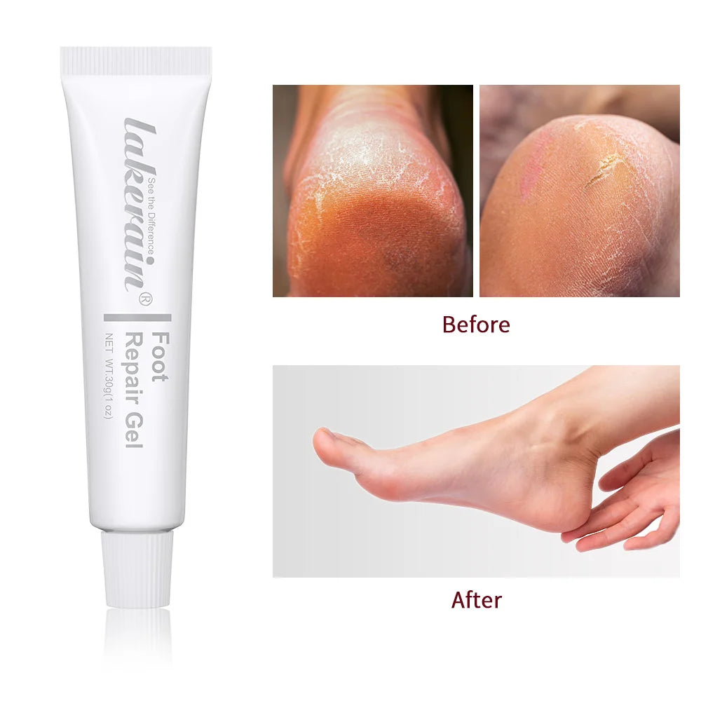 Foot & Hand Repair Gel Cream – Exfoliating Moisturizer 30g