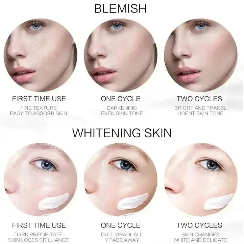 1/3/5pcs Whitening Freckle Cream Niacinamide Remove Dark Spot Cream Anti Freckle and Aging Cream Fade Pigmentation Melasma Skin Oasis Select