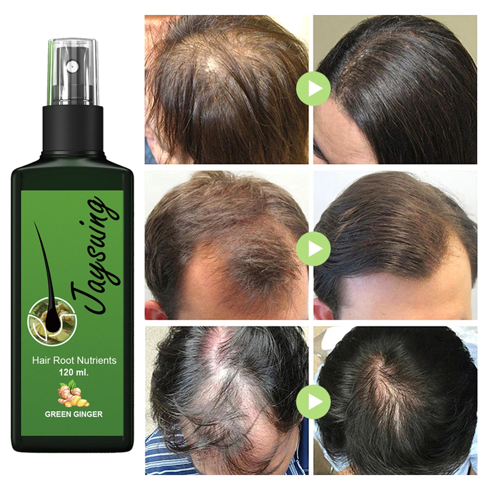 Nourishing Hair Care Serum Spray – Scalp & Smoothing Treatment Hair Serum Spray Oasis Select