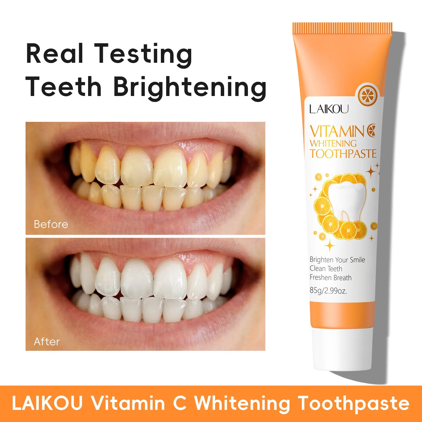Laikou Sakura or VC Whitening Toothpaste Stains Removing Prevent Bad Breath Oral Cleaning Refreshing Reduces Plaque Dentifrice Oasis Select
