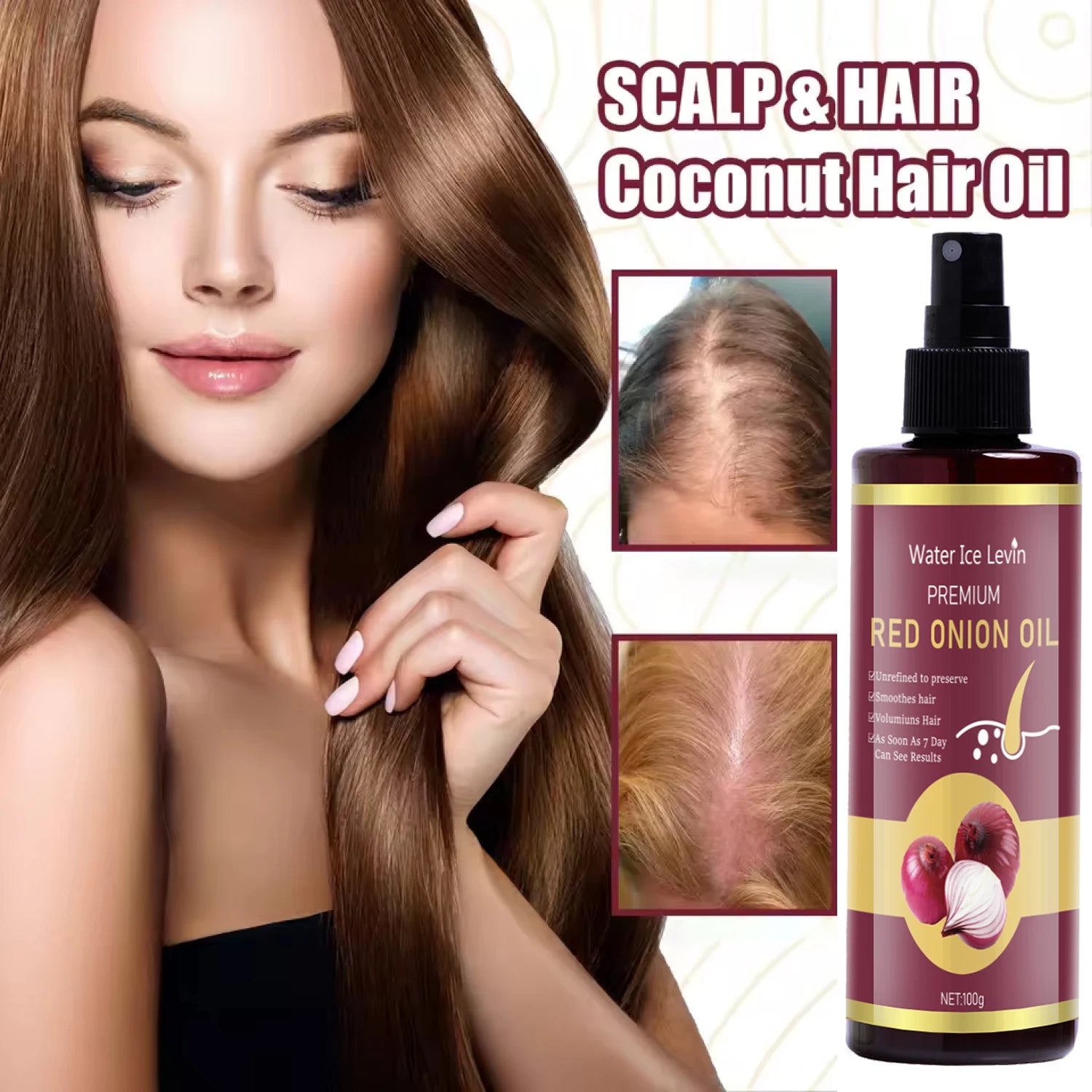 Red Onion Hair Oil with Keratin & Biotin – All Hair Types, 100g Hair Oil Essence Oasis Select