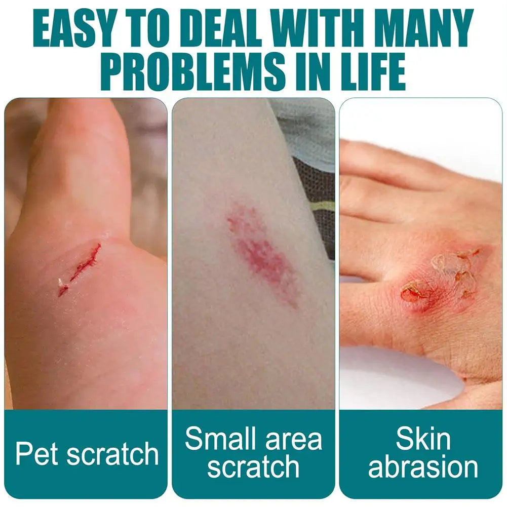 Liquid Bandage Wound Healing Gel – Waterproof & Breathable Liquid Wound Bandage Oasis Select