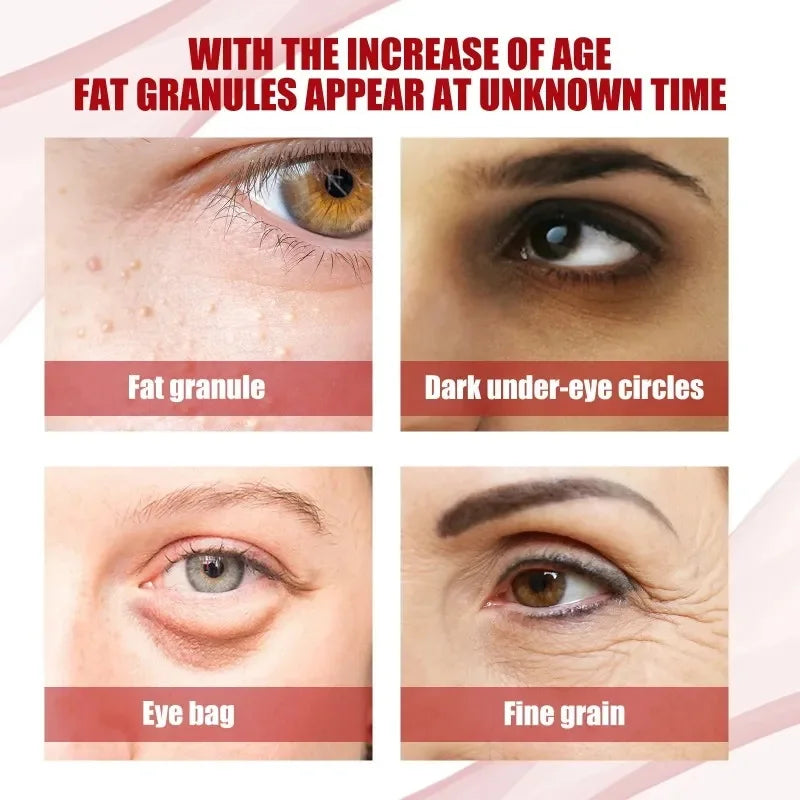 Hoygi Eye Cream | Dark Circles, Puffiness & Fine Lines Eye Cream Oasis Select