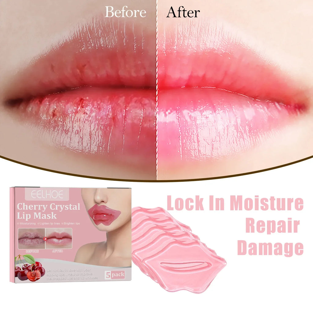 EELHOE Cherry Lip Mask – Moisturize, Fade Lines & Repair (5pk) Lip Mask Treatment Oasis Select