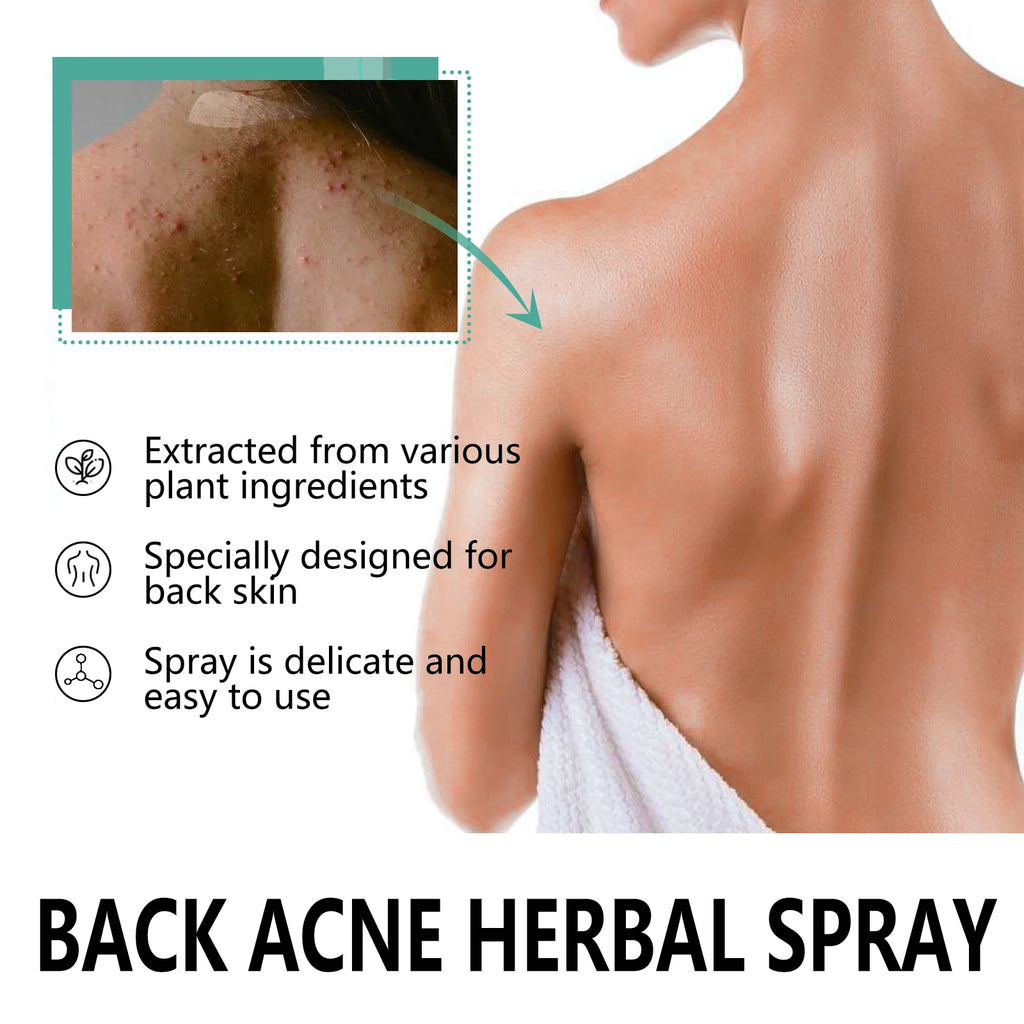Herbal Acne Remover Spray Back Shoulder Pimple Treatment Blackhead Anti Mites Oil Control Repair Smooth Skin Care Beauty Health Oasis Select