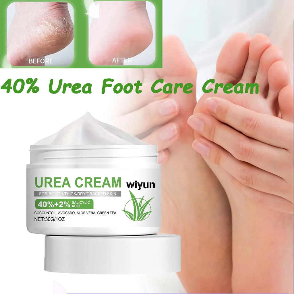 40% Urea Foot Care Cream Overnight Moisturizing Removes Dead Skin Nourishing Dry Rough Repair Cracked Heels & Calluses Moisture Oasis Select