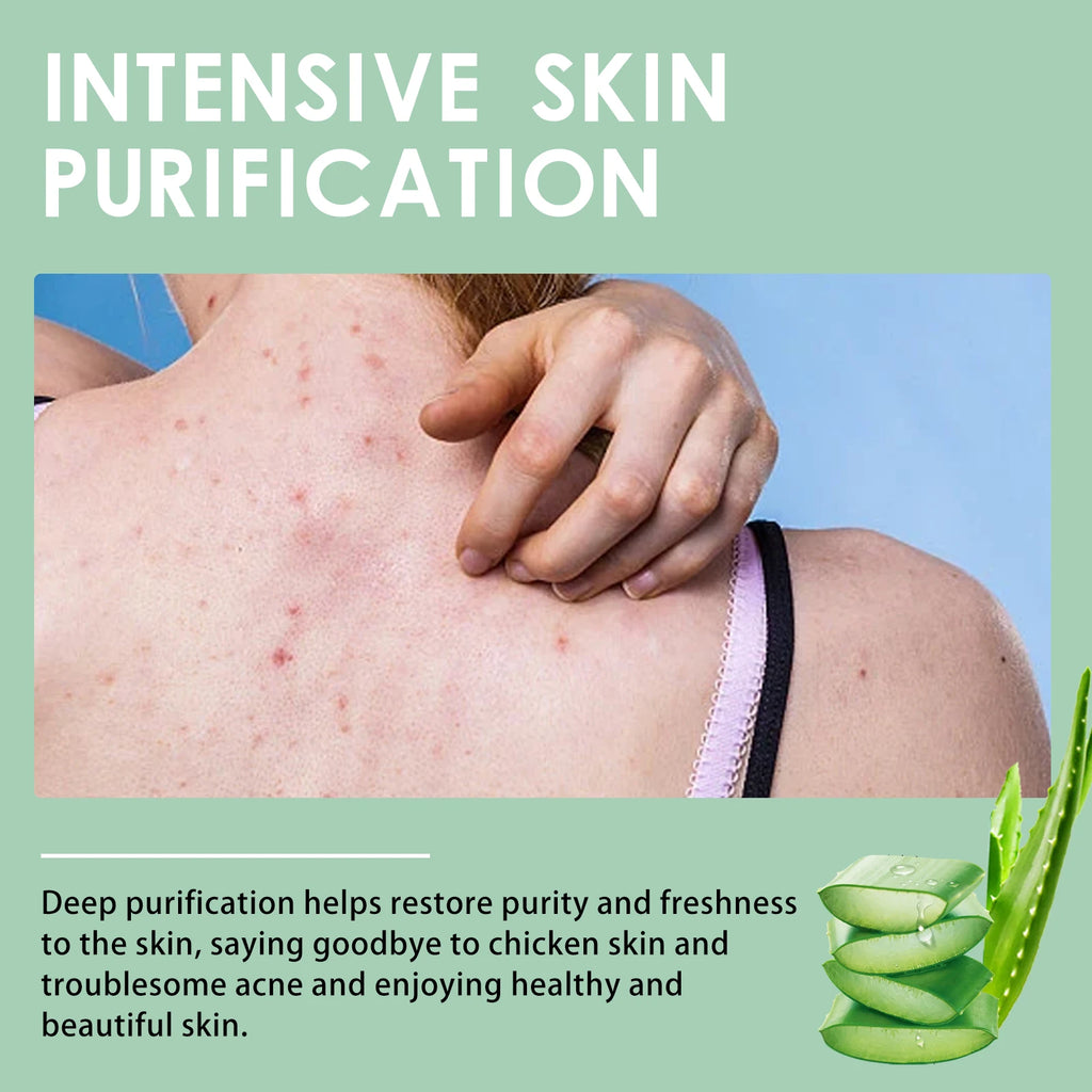 Keratosis Pilaris Repair Cream – Smooth Bumpy Chicken Skin Body Repair Cream Oasis Select