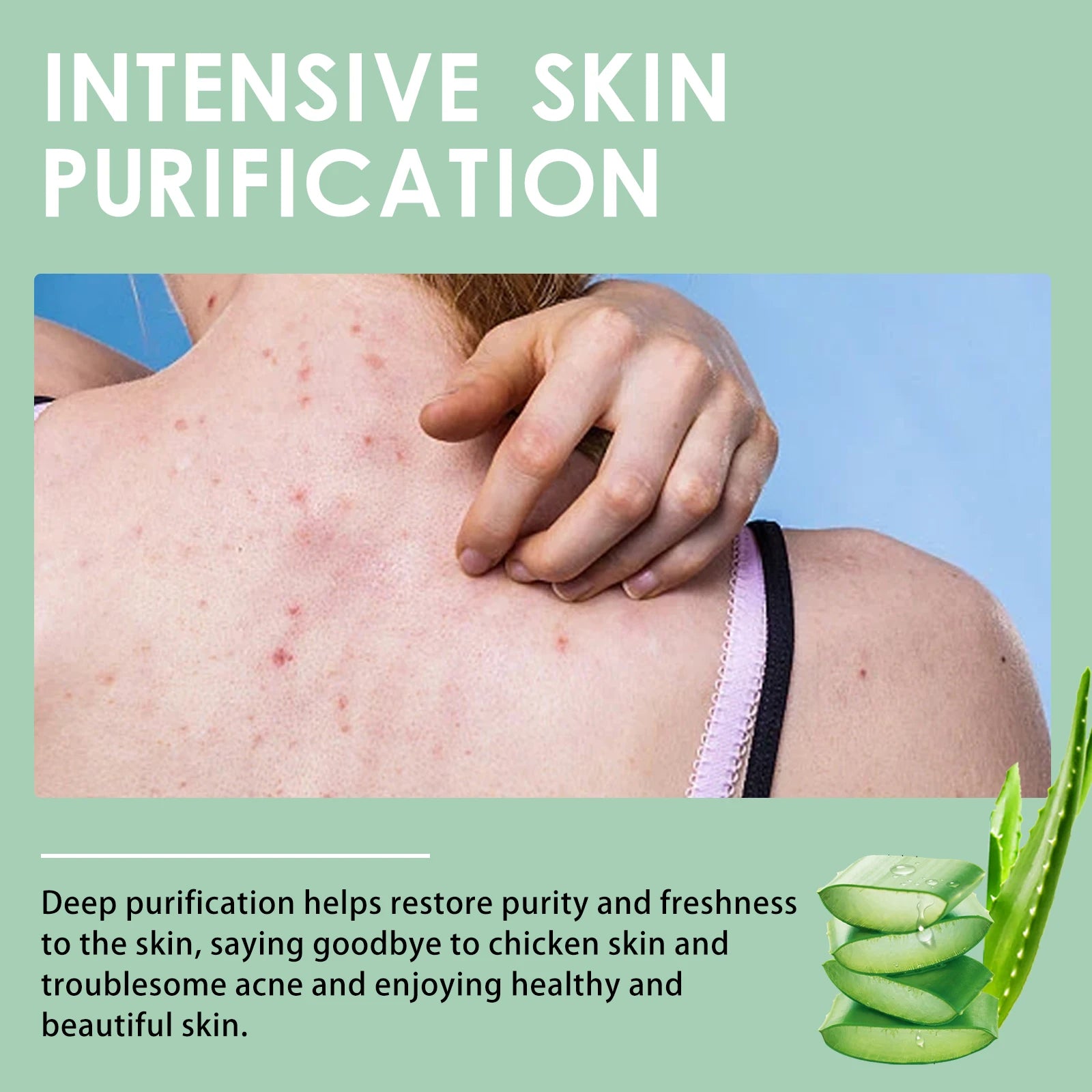 Keratosis Pilaris Repair Cream – Smooth Bumpy Chicken Skin Body Repair Cream Oasis Select