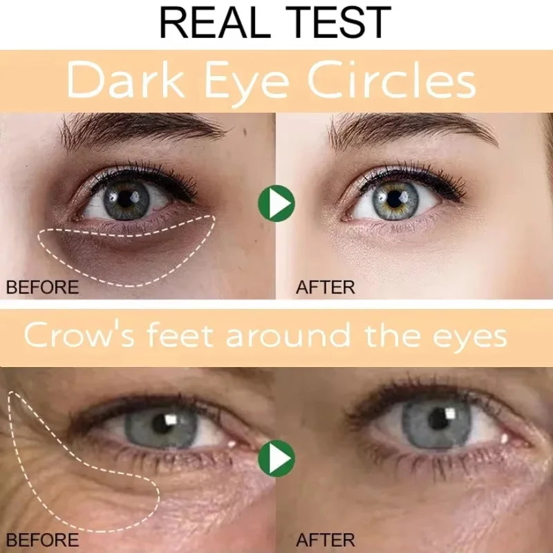 SADOER Retinol Eye Cream – Brighten, Firm & Hydrate Eye Cream Oasis Select