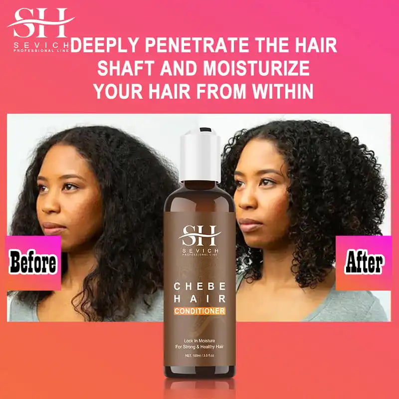 SEVICH Chebe Hair Growth Shampoo & Conditioner Set | Anti Hair Loss Hair Growth Shampoo Set Oasis Select