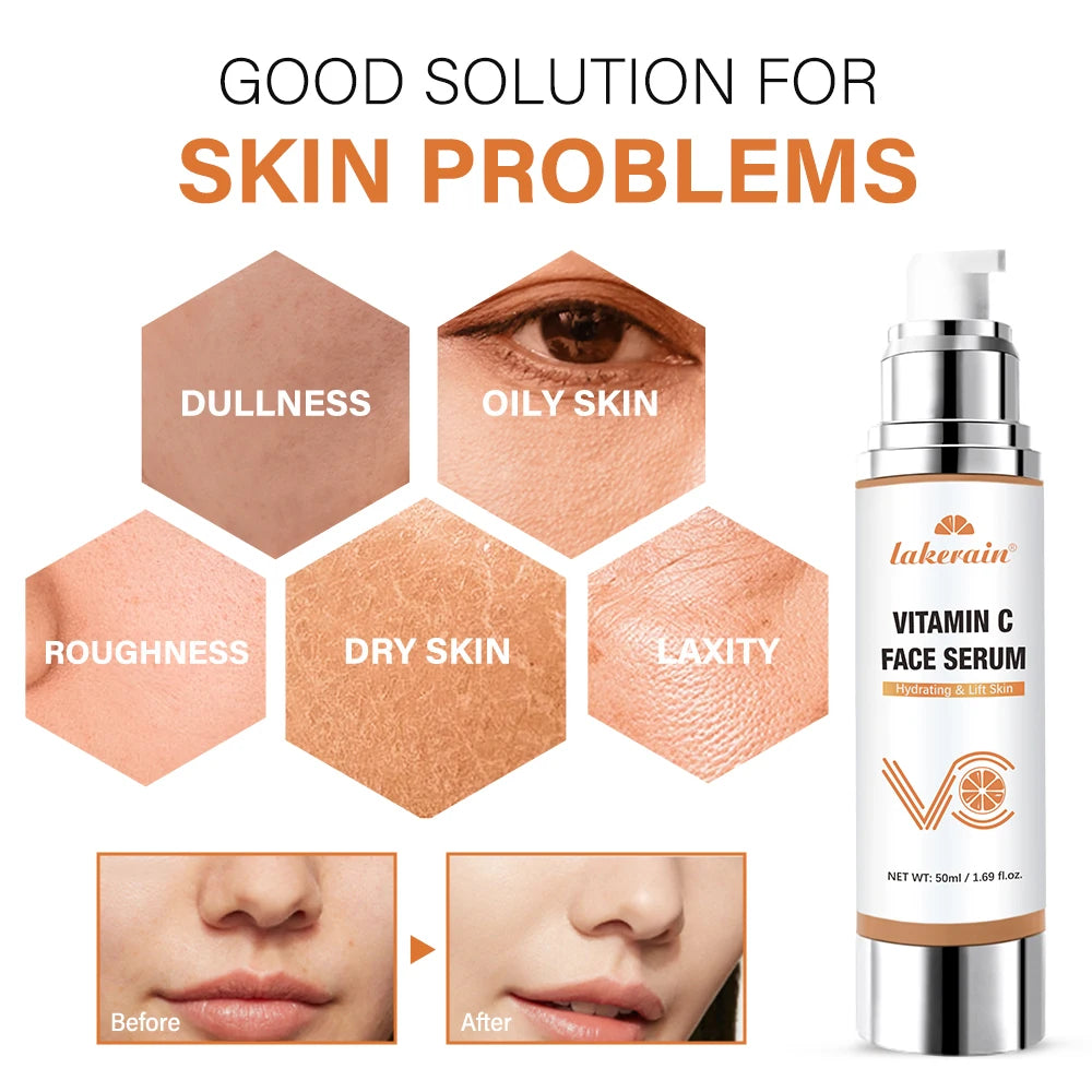 Vitamin C Face Serum – Dark Spot, Hyaluronic Acid & Anti-Aging