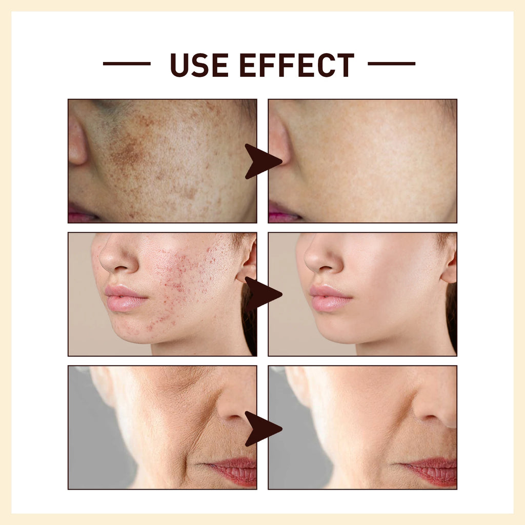 Rice Extract Anti-Wrinkle Face Serum – Hydrating & Firming