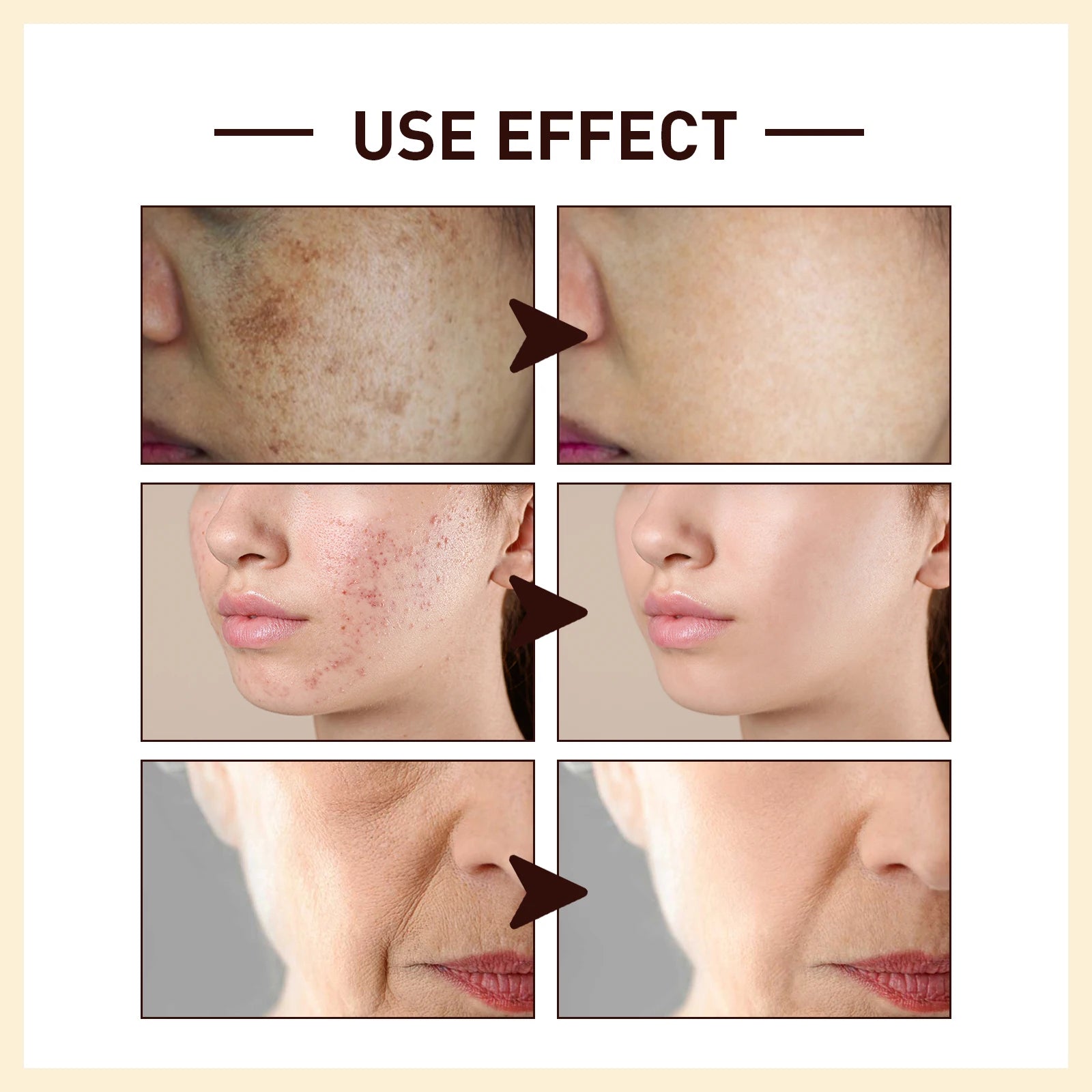 Rice Extract Anti-Wrinkle Face Serum – Hydrating & Firming