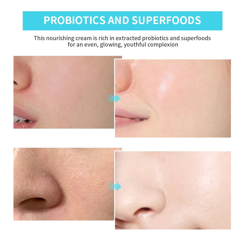 Probiotics Hydrating Cream Long-lasting Moisture Solve Dry Dull Skin Reduce Fine Lines Improve Skin Elasticity Skin Care Product Oasis Select
