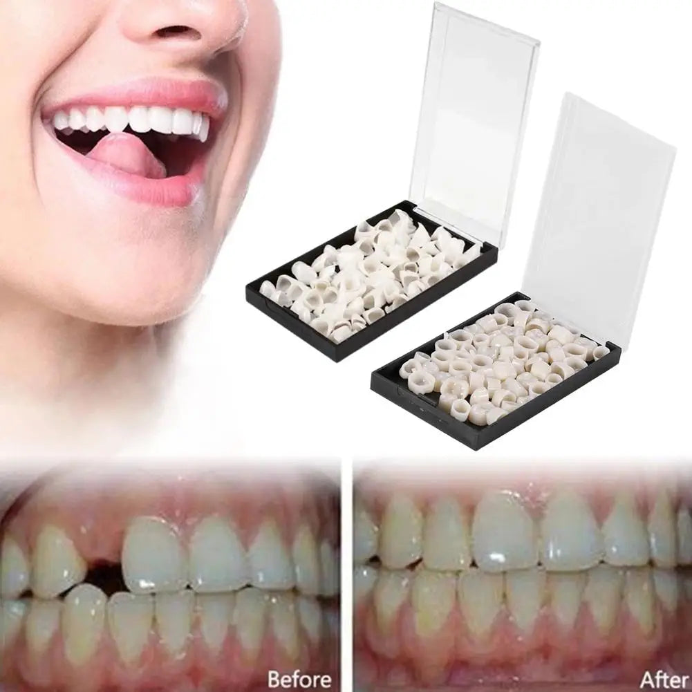 Temporary Dental Crowns Set 150pcs – Anterior & Posterior Temporary Dental Crowns Oasis Select