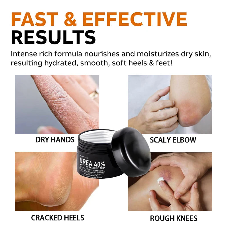 40% Urea Foot Cream – Deep Moisturizing for Dry Heels, 100g