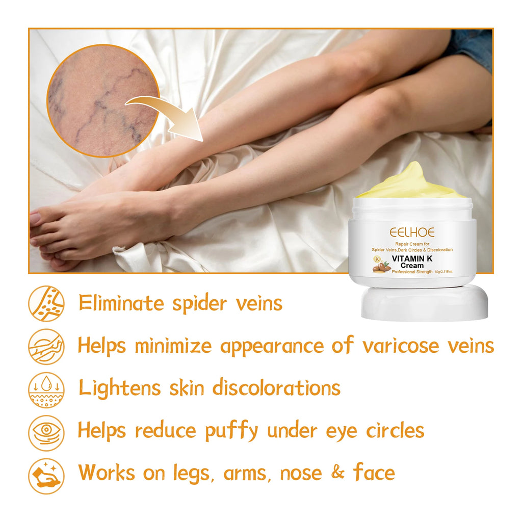Vitamin K Cream Effective Varicose Vein Relief Cream Massage Care Relieve Leg Soreness Swelling Phlebitis Spider Pain Ointment Oasis Select