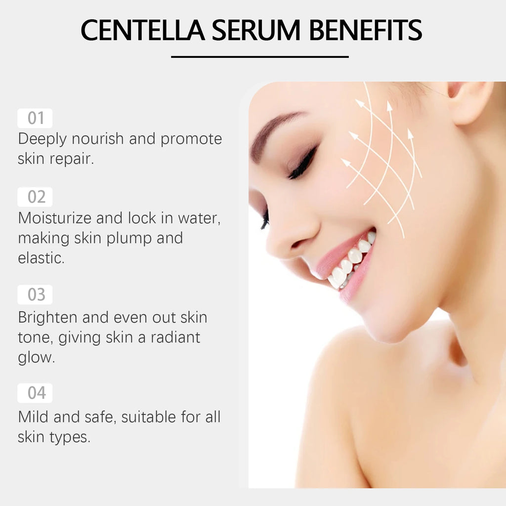 Eelhoe Centella Serum – Brightening, Pore Repair & Calming
