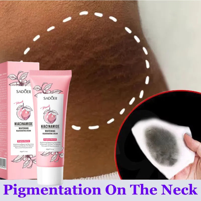 SADOER Brightening Body Cream – Underarm, Thigh & Intimate Skin Brightening Body Cream Oasis Select