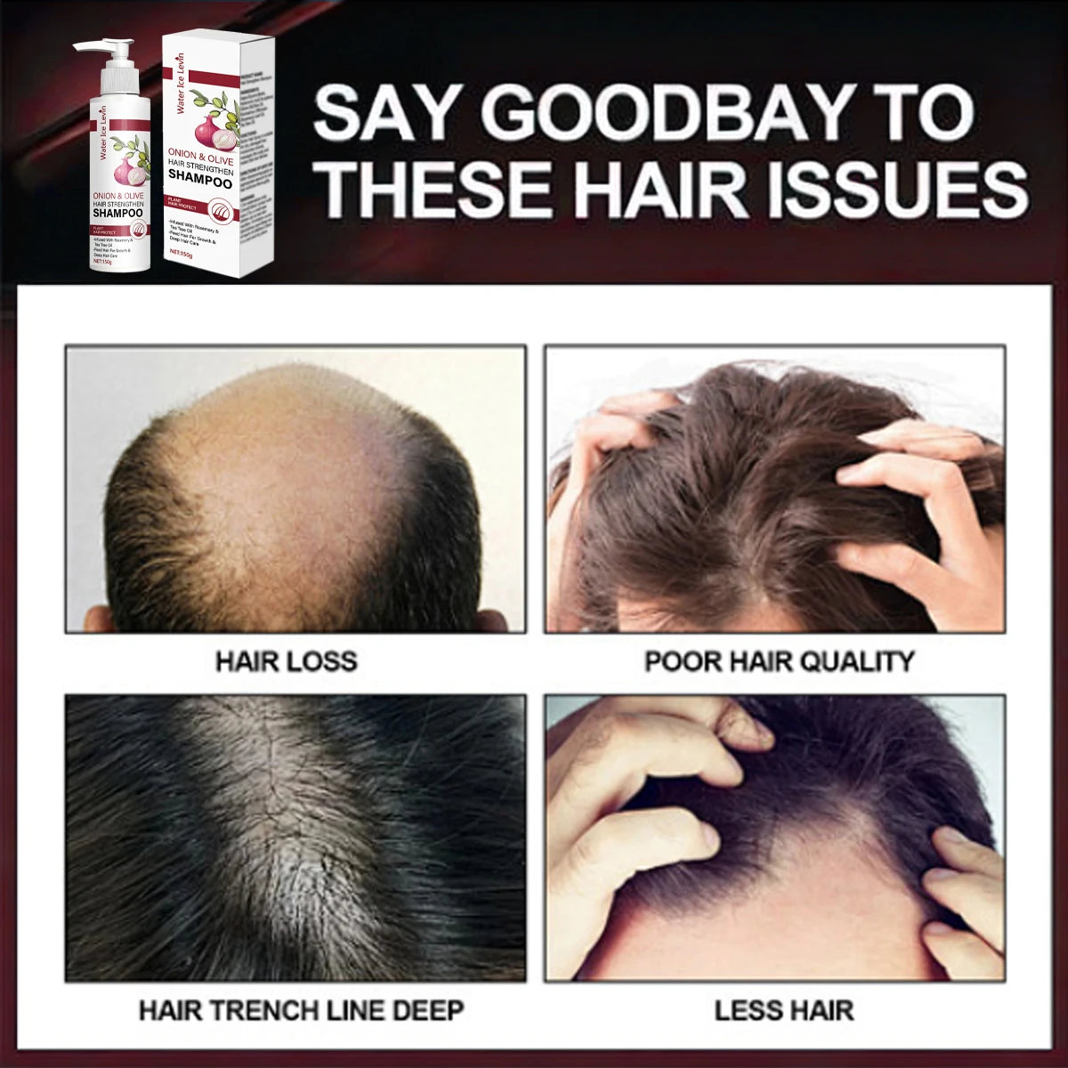 Onion & Olive Shampoo with Biotin & Rosemary – Hair Growth Strengthening Shampoo Oasis Select
