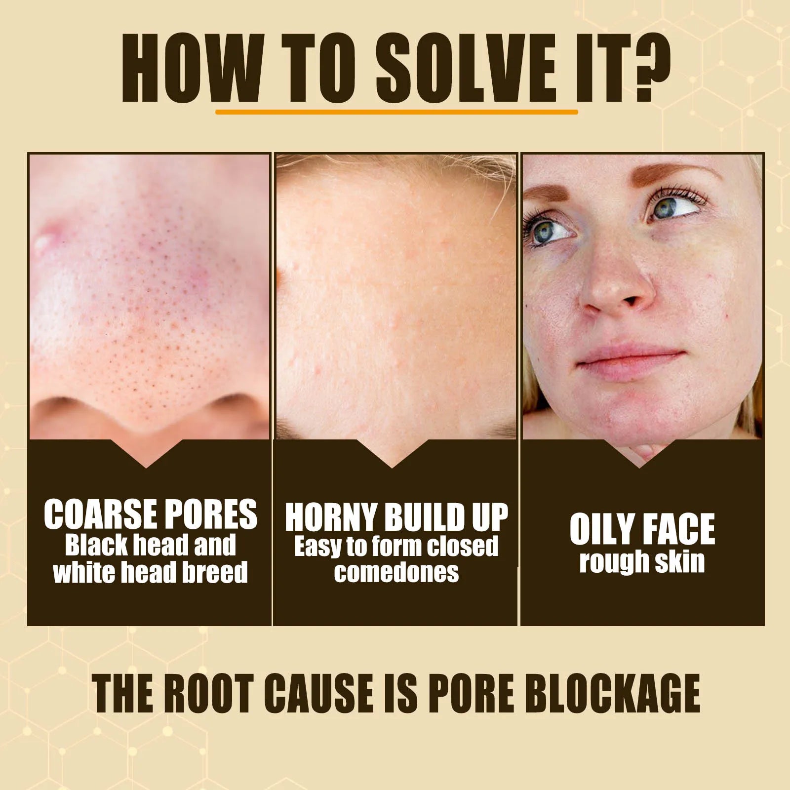 Eelhoe Pore Minimizer Serum – Exfoliating & Skin Repair 30ml Pore Minimizer Serum Oasis Select