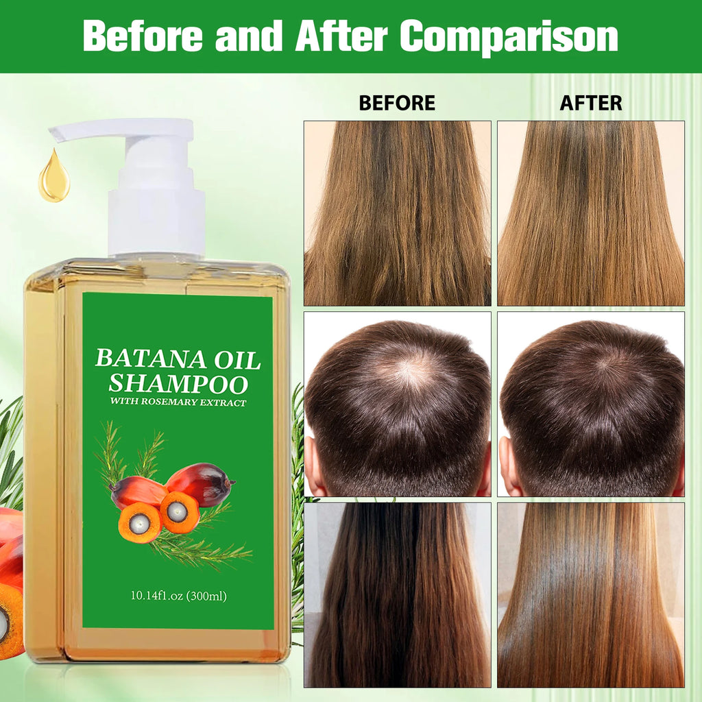 Batana Oil Shampoo & Conditioner Set – Hair Growth & Repair Hair Growth Shampoo Set Oasis Select